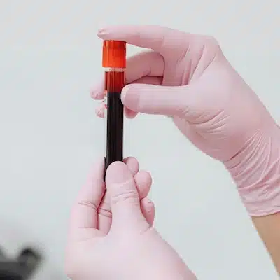 Longevity Blood Tests