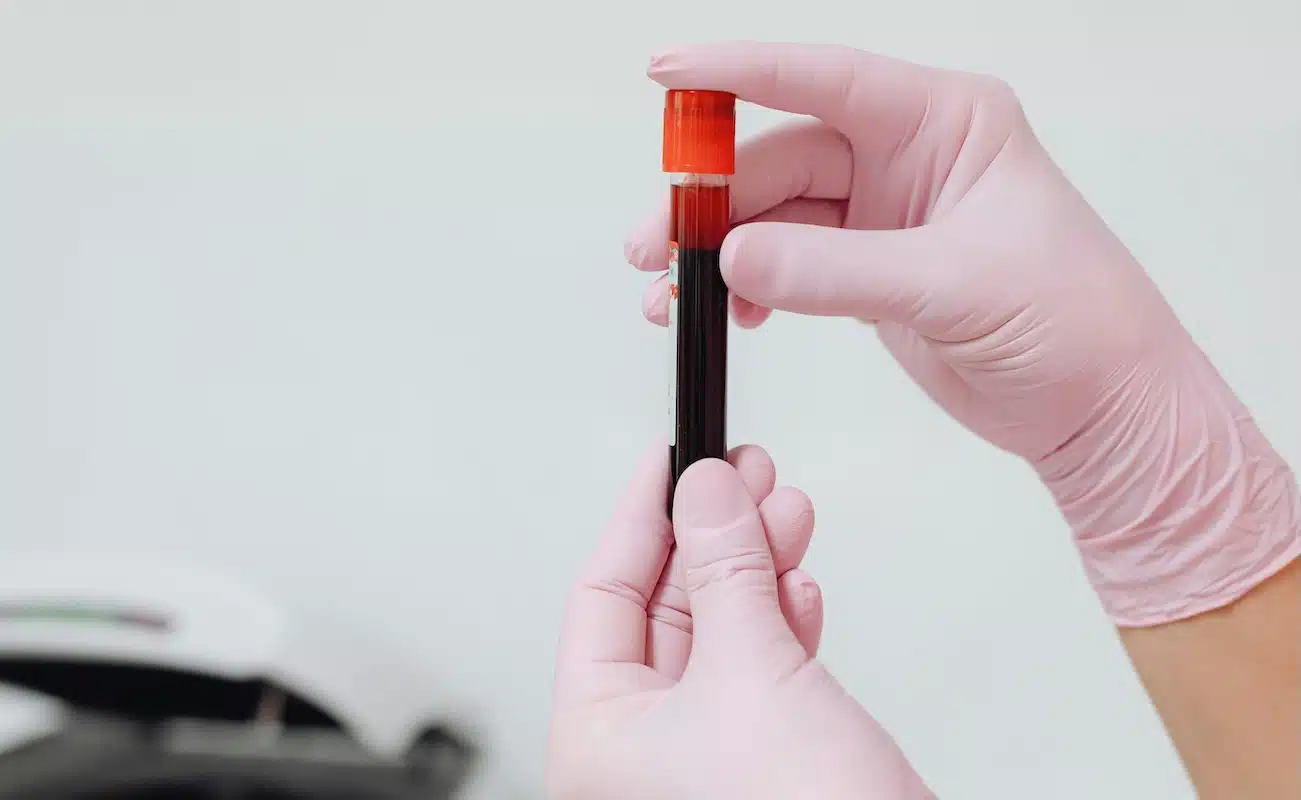 longevity health tests