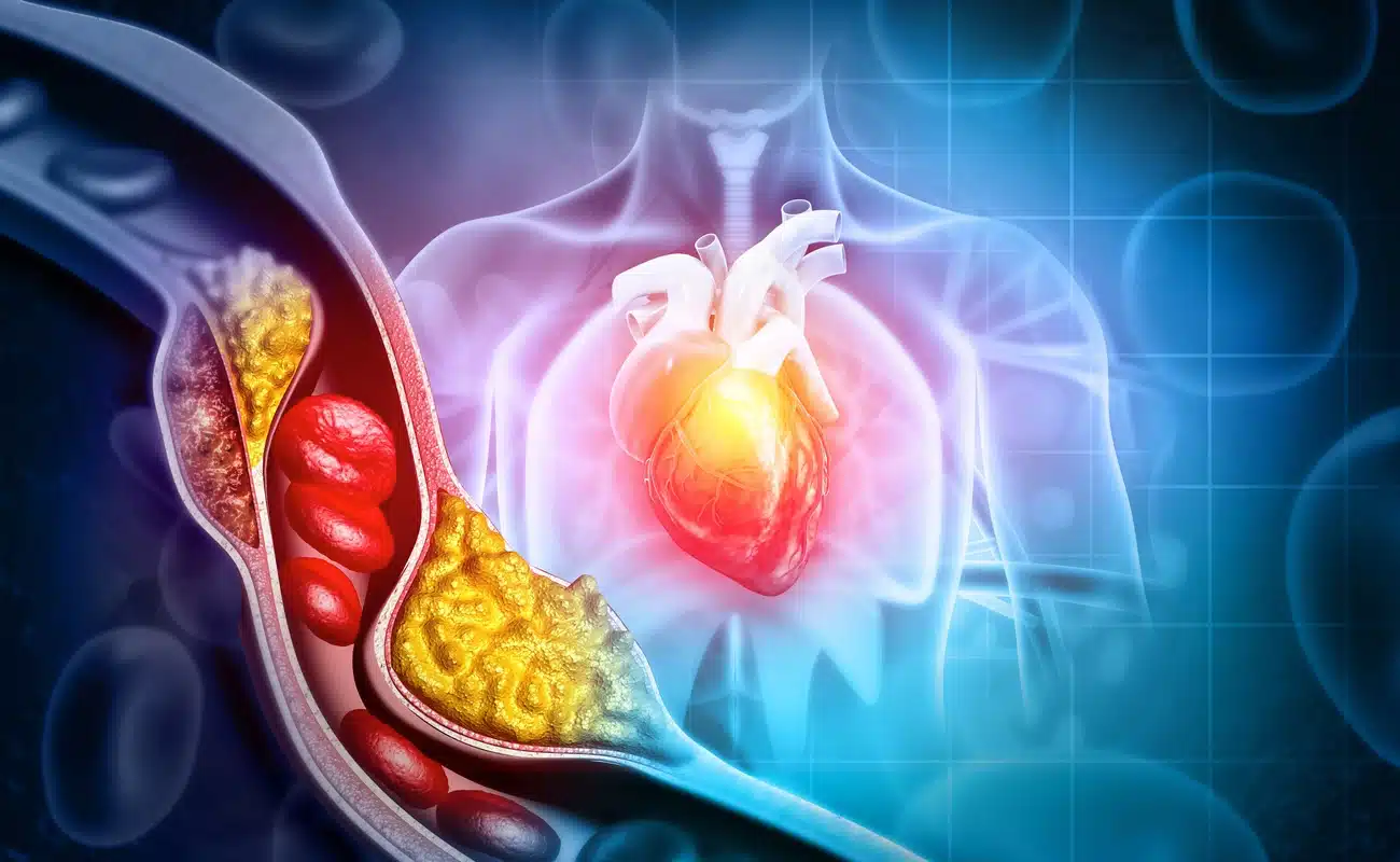 Cholesterol