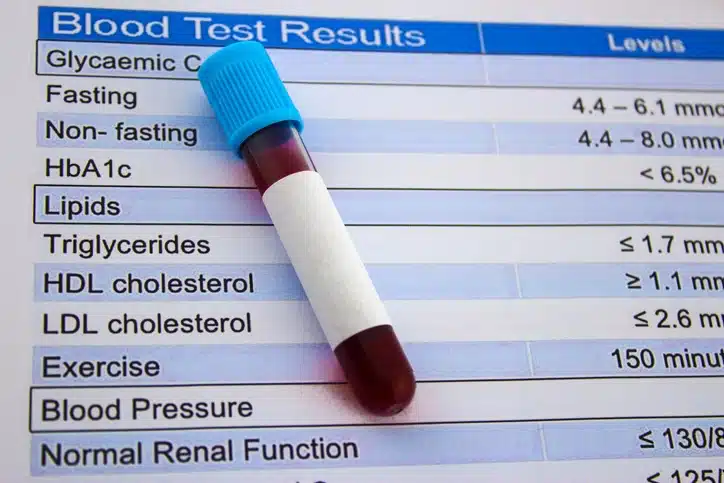 Triglycerides